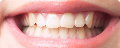 嚙み合わせ(咬合)