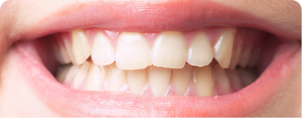 嚙み合わせ(咬合)